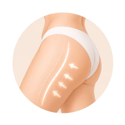 fat reduction fat reduction