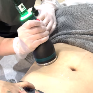 onda - treatment